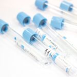 Вакуумные пробирки для забора крови №9