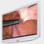 Видеомонитор медицинский Sony 55 дюймов 4К