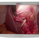 Видеомонитор медицинский NDS Radiance 26 дюймов